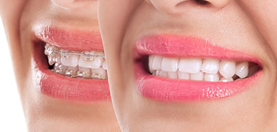 River Oaks Advanced Dentistry | CEREC, Veneers and Family Dentistry