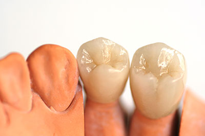 River Oaks Advanced Dentistry | Oral Exams, Veneers and Extractions