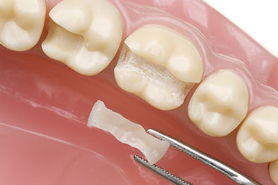 River Oaks Advanced Dentistry | Extractions, Cosmetic Dentistry and Oral Exams