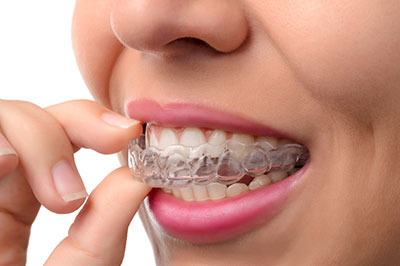 River Oaks Advanced Dentistry | Preventative Program, Sleep Apnea and Periodontal Treatment