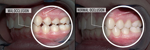 River Oaks Advanced Dentistry | Dentures, Botox reg  and Family Dentistry