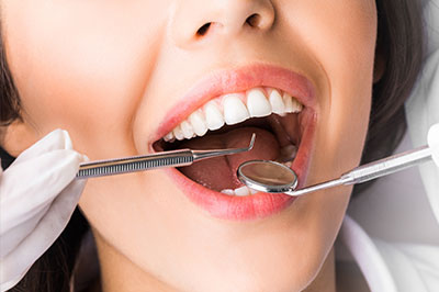 River Oaks Advanced Dentistry | Preventative Program, Oral Exams and Oral Cancer Screening