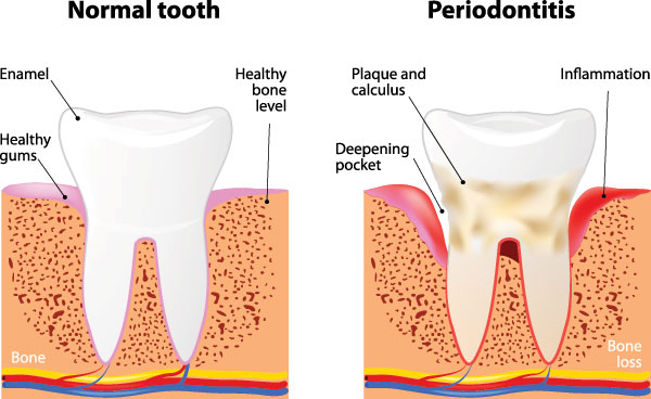 River Oaks Advanced Dentistry | ZOOM  Whitening, Dental Fillings and Sedation Dentistry