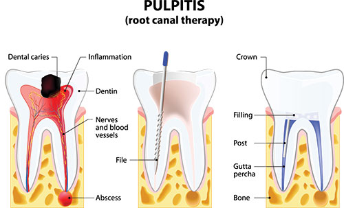 River Oaks Advanced Dentistry | Emergency Treatment, VELscope reg  Cancer Screening and Cosmetic Dentistry