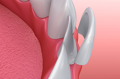 River Oaks Advanced Dentistry | Dental Fillings, CEREC and Sedation Dentistry
