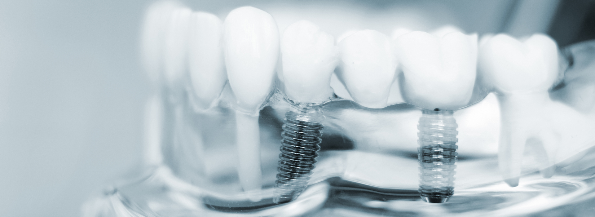 River Oaks Advanced Dentistry | Periodontal Treatment, TMJ Disorders and Digital Radiography